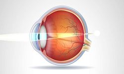 Hipermetrop Nedir? Göz Sağlığına Dair Genel Bir Bakış