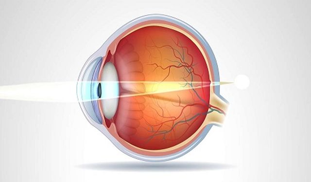 Hipermetrop Nedir? Göz Sağlığına Dair Genel Bir Bakış
